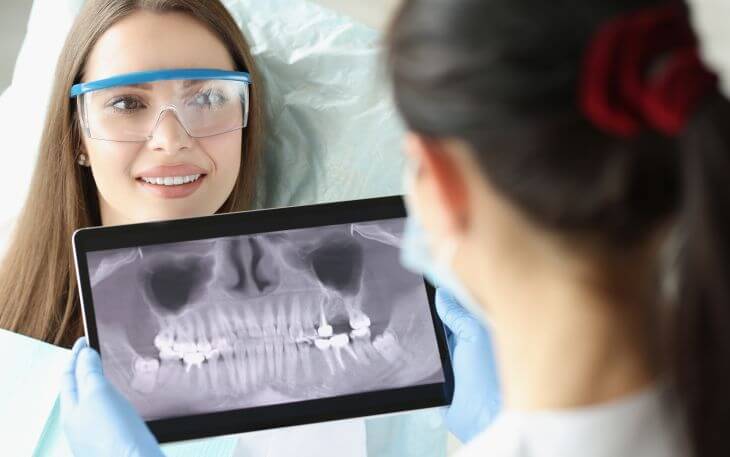 A dentist looking at dental x-rays of the woman patient's complaining about the bone spur in mouth after tooth extraction